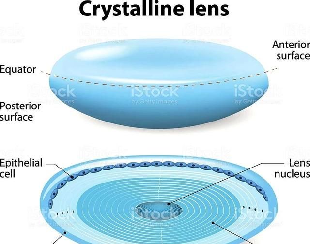 近视眼的晶状体特点(lens折叠式人工晶状体怎么样)图2