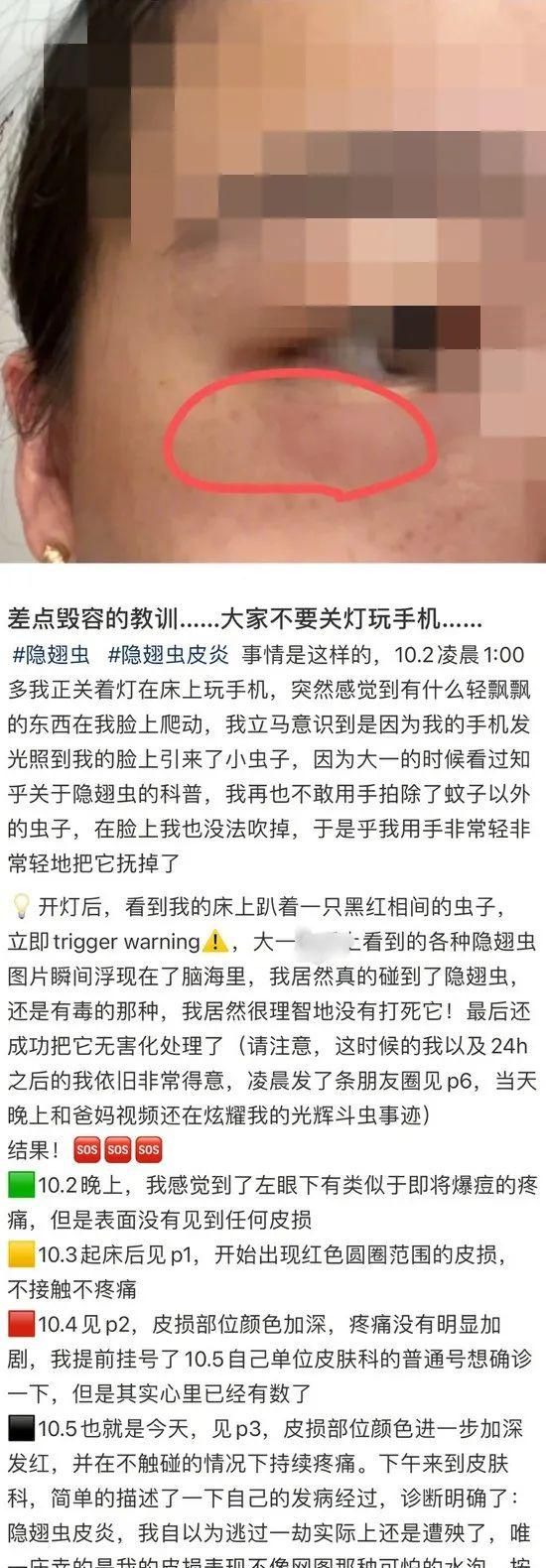 一只不起眼的小虫子就可以毁容图1