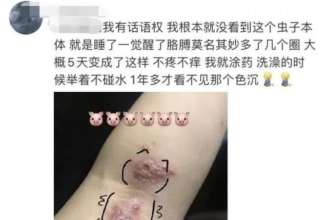 一只不起眼的小虫子就可以毁容图5