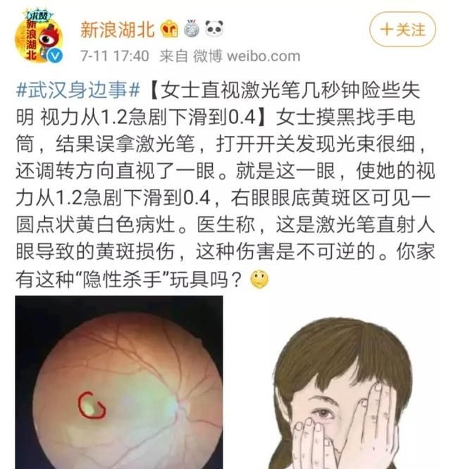 激光笔对眼睛的伤害有多大图2