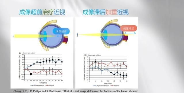 雾视疗法怎么配镜,雾视镜的雾视量怎么算图5