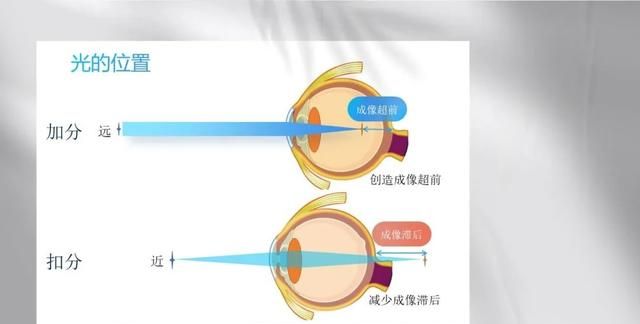 雾视疗法怎么配镜,雾视镜的雾视量怎么算图6