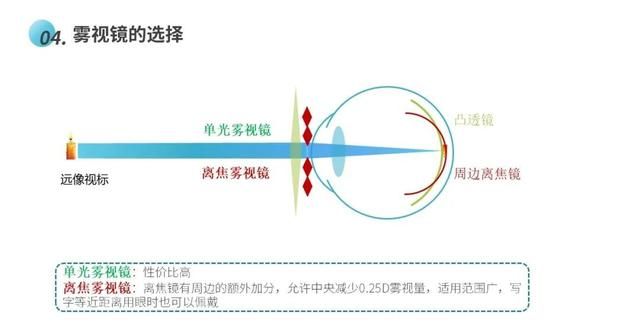 雾视疗法怎么配镜,雾视镜的雾视量怎么算图14