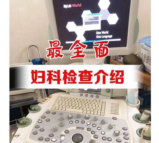 妇科检查有哪几项图3