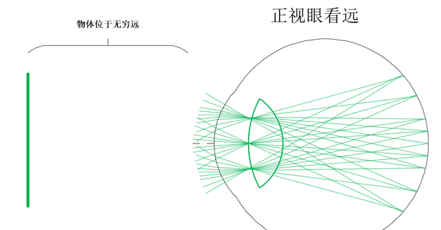 如何科学配镜,戴镜方法,如何科学配镜图1