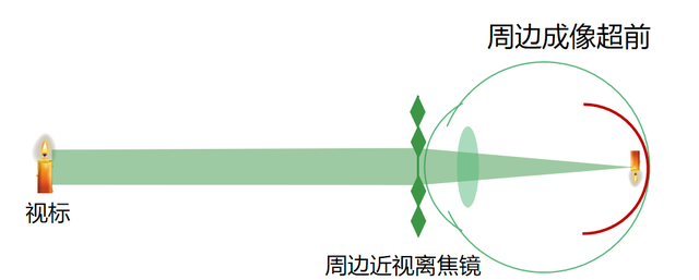 如何科学配镜,戴镜方法,如何科学配镜图4