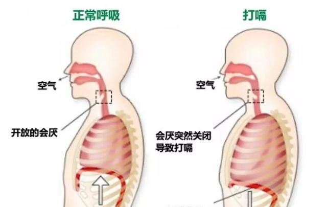 打嗝怎么办,打嗝怎么办快速止嗝 倪海厦图9