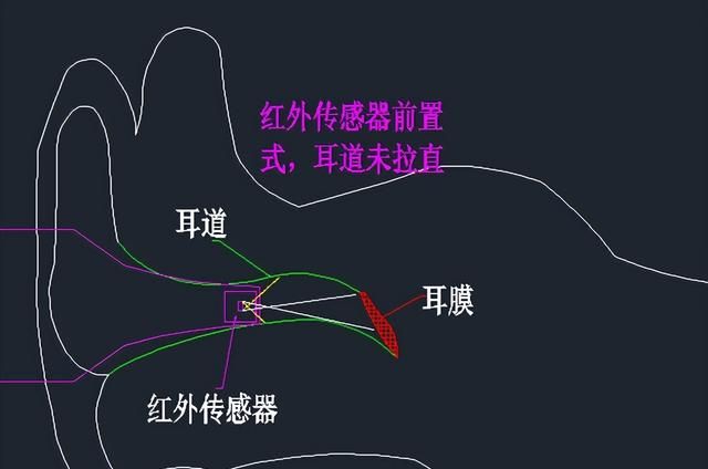 体温计种类繁多如何选择和使用(体温计种类太多怎么选)图8