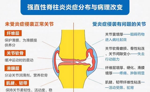 强直怎么办(去大脑强直)图3