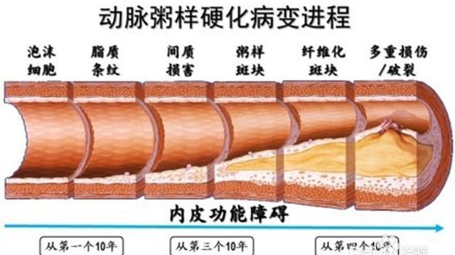 阿斯匹林正常人可以服用吗图2