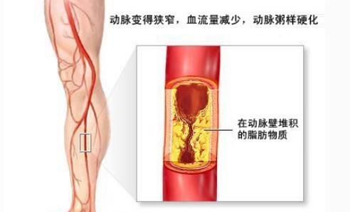 阿斯匹林正常人可以服用吗图4