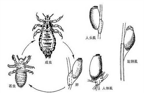 孩子们是如何被头虱盯上的？