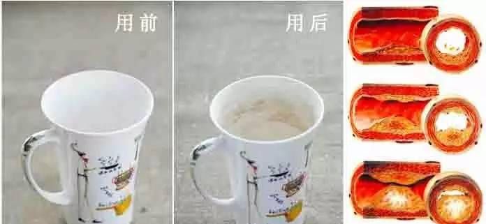 刮痧能减肥吗，刮痧后可以运动吗
图2