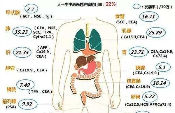 有一种检查肺癌需要一万元这是什么检查项目图4